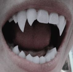 an open mouth with white teeth and gums