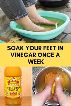 Soak Your Feet in Vinegar Once a Week Apple Cider Vinegar Feet Soak, Dry Feet Remedies Foot Soaks, Soften Feet Overnight, Smelly Feet Remedies, Stinky Feet Remedy, Cracked Feet Remedies, Swollen Feet Remedies, Dry Feet Remedies