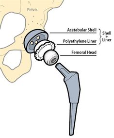 the bones are labeled in this diagram, and there is no image on it to describe