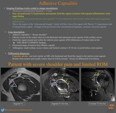 an article about the different types of mris and how they are used for medical purposes