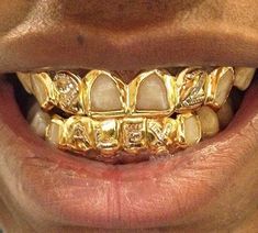 Mouth Grillz, Gold Teeth Grills, Gold Grills, Pretty Teeth, Dental Jewelry, Diamond Grillz, Gold Grill, Diamond Teeth