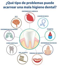 Oral Health Education, Dental Decay, Dental Posters, Dental Health Care, Dental Implants Cost, Kedokteran Gigi, Dental Facts, Teeth Health, Periodontal Disease