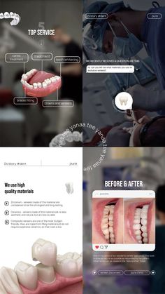 Dentist Content Ideas, Dentist Instagram Posts, Dental Post Ideas, Dentist Website Design, Dental Marketing Social Media, Dental Instagram, Dental Content, Dental Post, Dentist Social Media