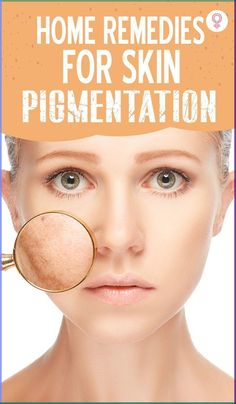 Home Remedies For Skin Pigmentation: Hyperpigmentation is mostly caused by sun damage. However, it may also indicate underlying conditions or caused due to medication side effects. If you have developed hyperpigmentation due to improper skin care and sun damage, you may try some home remedies to fade these skin pigmentation issues. While they may not be as effective as medical treatments, you may see the results gradually. Medication Side Effects, Remedies For Skin, Home Remedies For Skin, Tips For Acne, Skin Pigmentation, Working Mom Tips, Saggy Skin, Large Pores, Deep Wrinkles