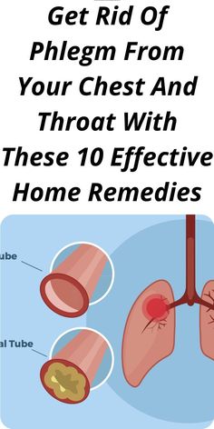 Get Rid Of Phlegm From Your Chest And Throat With These 10 Effective Home Remedies Getting Rid Of Mucus, Chest Congestion Remedies, Congestion Remedies, Getting Rid Of Phlegm, Chest Congestion, Home Remedy For Cough