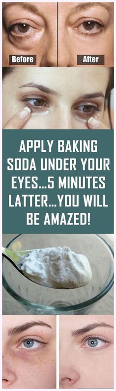 Apply Baking Soda Under Your Eyes…5 Minutes Latter…You Will be Amazed! Exercise Challenges, Baking Soda Face Mask, Baking Soda Face, Homemade Face Mask, Baking Soda Benefits, Short Article