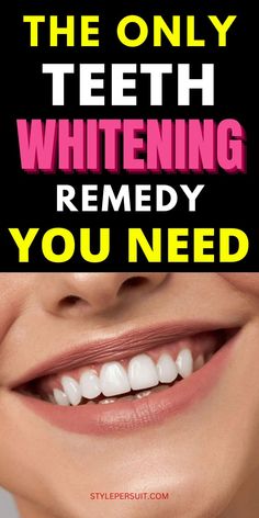 A bright, radiant smile is often considered a person's best accessory. It exudes confidence, warmth, and health. Say goodbye to teeth stains and yellow teeth. Learn how to whiten teeth wth the best teeth whiting remedies that work really overnight Try Natural Teeth Whiting at Home Remedies today Homemade Teeth Whitening, Whiten Teeth At Home, Picture Perfect Smile, Teeth Whitening Methods, Braces Tips, Teeth Whitening Homemade