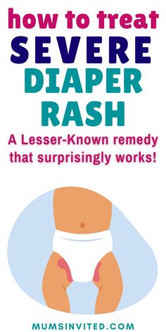 Find out how to use egg white for nappy rash, and what every parent should LOOK OUT FOR before applying egg white to your baby's sore bottom. Nappy Rash Remedies Natural, Diaper Rash Remedy Severe, Natural Diaper Rash Remedies, Skin Rash On Face, Home Remedies For Rashes, Rash Remedies, Diaper Rash Remedy, Rashes Remedies, Home Remedies For Allergies