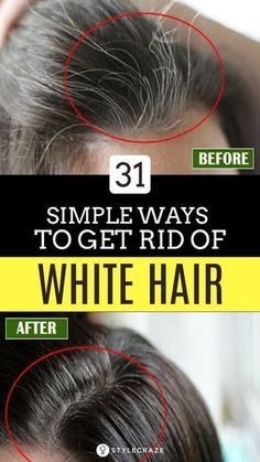 White Hair Remedies, Get Rid Of White Hair, Cover Gray Hair Naturally, Remedy For White Hair, Grey Hair Home Remedies, Hair Home Remedies, Grey Hair Remedies, Cover Gray Hair, Prevent Grey Hair