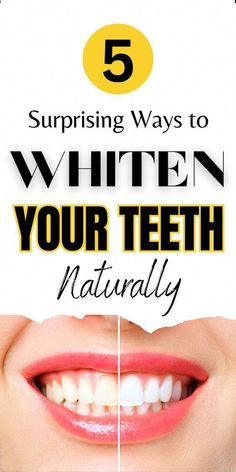 Toothache Relief, Picture Perfect Smile, Teeth Aesthetic, Turmeric Paste, Tooth Ache Relief, Teeth Whitening Diy, Whiten Your Teeth, Whiter Teeth