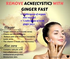 Severe Acne Remedies, Cystic Acne Remedies, Chest Acne, Organic Aloe Vera Gel, Get Rid Of Acne, Rid Of Acne, Natural Acne Remedies, Natural Acne