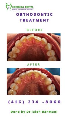 Orthodontic in Etobicoke Dental Braces, Family Dental