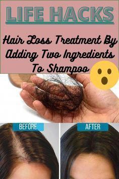 #HomeRemediesForHairLossInFemales Life Hacks Hair, Hair Growth Formula, Hair Growing Tips, Hair Shedding