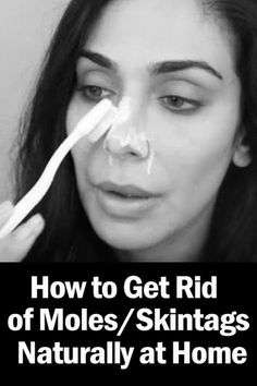 Skin Tags And Moles Can Be Removed Just By Doing This Wrinkles Remedies Face, Diy Beauty Treatments, Skin Tags, Skin Care Wrinkles, Beauty Remedies, Skin Care Remedies, Beauty Makeup Tips, Beauty Skin Care Routine, Health And Beauty Tips