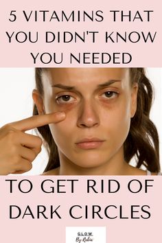 What deficiency causes dark circles ? This question is answered by a pharmacist to ensure your diet is optimised to reduce dark circles fast Green Tea Face, Remove Dark Circles, Dark Circles Under Eyes, Reduce Dark Circles, Dark Under Eye, Face Wrinkles, Undereye Circles, Acne Remedies, Ageless Beauty