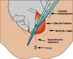 an image of a diagram of the pelvicil and its attachments in human body