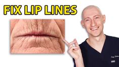 How to FIX Lip Lines | Treatments for Lip Wrinkles Upper Lip Wrinkles How To Get Rid, Lip Lines Wrinkles, How To Get Rid Of Lip Lines, Wrinkly Lips, Upper Lip Wrinkles, Surgeon Doctor, Wrinkle Filler, Makeup Tips For Older Women, Lip Wrinkles