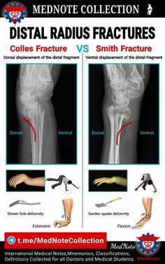 an image of the knee with different types of medical instruments on it and in front of them