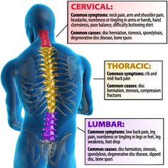 Spine Pain, Sciatic Nerve, Joints Pain Relief, Leg Pain