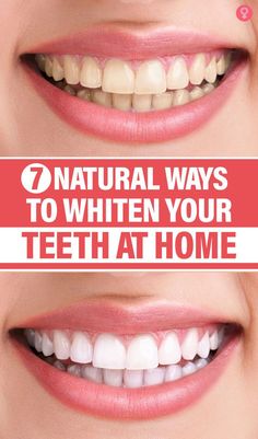 Eating highly acidic and sugary foods, drinking alcohol, smoking tobacco, and a host of other factors contribute to your teeth losing their white color. There are many products and dental procedures out there that promise you white teeth but burn holes in your pockets, so opt for ingredients that can naturally whiten your teeth. Whiten Your Teeth At Home, Whiten Your Teeth, Impossible Dream, Drinking Alcohol, Dental Procedures, Handy Dandy, Large Pores, Simple Home, White Teeth