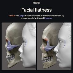 an image of two human heads with facial flatnesss on the forehead and lower jaw