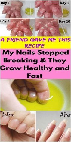 Face Hacks, 2016 Nails, Weak Nails, Transparent Nails, Strong Nails, Healthy Nails, My Nails