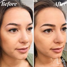 Brow Tint Vs Microblading, Hybrid Brows, Microblading Eyebrows After Care, Tattoo Brows, Eyebrow Before And After, Micro Blading, Full Eyebrows