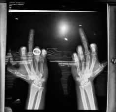 an x - ray image of two hands holding something