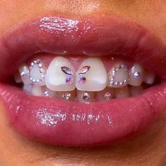 Tooth Gems Front Teeth, Tooth Gem Placement, Tooth Gem Designs, Cute Grills, Teeth Jewels, Tooth Gem Ideas, Tooth Gems Ideas, Teeth Gems, Dental Jewelry