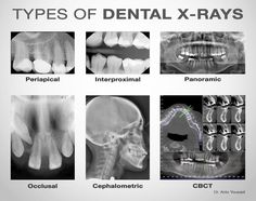 Dental Radiology, Dental Nurse, Dental World