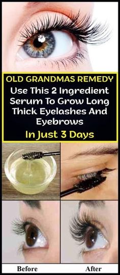 Grow Longer Thicker Eyelashes, Make Hair Grow Faster, Long Thick Eyelashes, Quick Hair Growth, Diy Serum, Thick Eyelashes, Make Hair Grow, Skin Care Routine For 20s