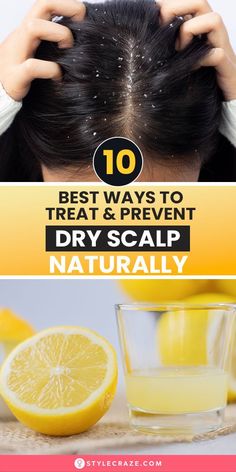 If you feel like scratching your head all the time, chances are you may have a dry scalp. We all develop a dry scalp at some point. Be it lifestyle changes, a shift in the weather, or some chemical in your product, a dry scalp can develop due to several reasons. Hair Color Swatches, Hair And Skin Vitamins, Natural Hair Care Routine, Hair Scrub, Scrub Corpo, Unwanted Facial Hair, Natural Healing Remedies