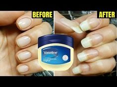 Strong Nails Diy Remedies, Strong Nails Diy, Long Strong Nails, Grow Long Nails, Nail Growth Tips, Grow Nails Faster, Nagel Tips, Smink Inspiration, Nail Care Tips