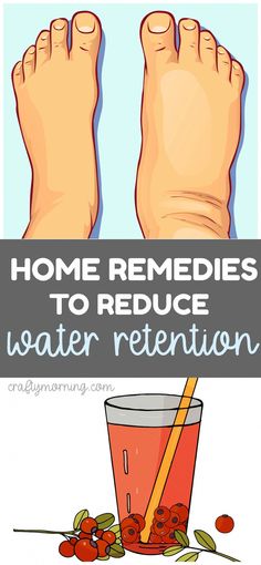 Swelling Remedies, Reduce Water Retention, Water Retention Remedies, Swollen Legs, Body Wrap, Healthy Diet Tips, Daily Health Tips, Water Retention, Good Health Tips