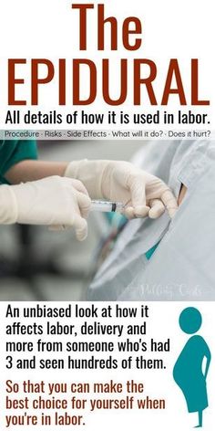 an ad for the epidural hospital shows how it affects labor, and what to do