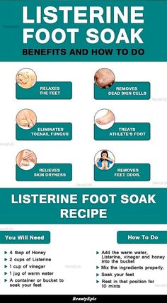 Listerine Foot Soak, Foot Soak Recipe, Bad Acne, Natural Skin Care Remedies, Home Health Remedies, Foot Soak, Skin Dryness, Vie Motivation, Skin Care Remedies