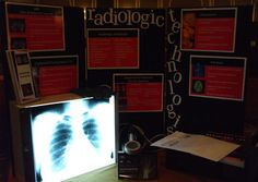 an x - ray image is displayed in front of a screen with information about radiology