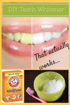 Use this DIY teeth whitener to shine up your teeth. This all natural recipe is easy to make and apply. Diy Teeth, Teeth Whitener, Teeth Whitening Remedies, Teeth Whitening Diy, Diy Teething, Pasta Dental, Oil Pulling, Natural Teeth Whitening, Natural Teeth