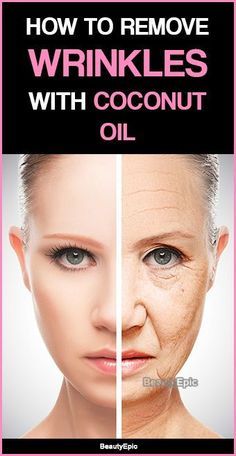 How to Remove Wrinkles with Coconut Oil Coconut Oil For Wrinkles, Coconut Oil Facial, Coconut Oil Skin, Wrinkle Remedies, Coconut Oil Skin Care, Anti Wrinkle Skin Care, Oil For Skin, Skin Care Wrinkles, Oil Skin