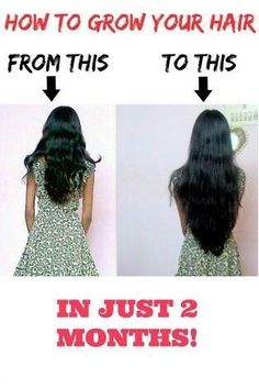 How To Grow Your Hair Faster, Grow Long Hair, Hair Treatments, Grow Hair Faster, Hair Remedies, Hair Growth Tips, Hair Problems