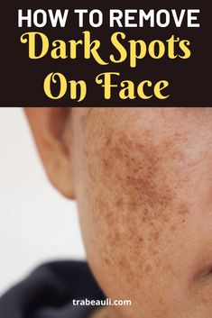 Overnight Remedies, Wrinkle Remedies, Natural Face Skin Care, Healthy Advice