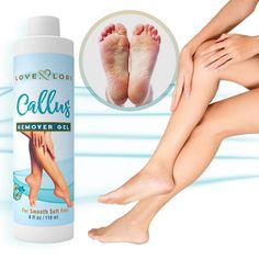 Callus gel by Love Lori- Introducing our nourishing Callus Remover Gel. Love, Lori’s Callus Remover Gel gives you the feet of your dreams, without spending a second (or cent) at the spa. Our gel works miracles to buff away dull, cracked skin leaving your feet looking and feeling supple and smooth. #LoveLori #callusremover Listerine Foot Soak, Dry Heels, Diy Spa Day, Make Up Inspiration, Gentle Baby, Callus Remover, Athletes Foot, Foot Spa, Diy Spa