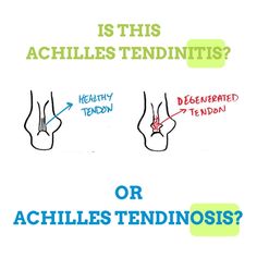 Achilles Tendon Strengthening Exercises, Achilles Bursitis, Strengthen Achilles Tendon, Ruptured Achilles, Insertional Achilles Tendinosis, Achilles Stretches