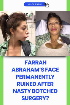 https://www.tvseasonspoilers.com/news/teen-mom-will-farrah-abrahams-face-ever-go-back-to-normal-after-nasty-botched-surgery/?fbclid=IwY2xjawHXTEBleHRuA2FlbQIxMAABHbB85NSIfEL20gj9Jj7B__-WboC9mRMQJDKfjt1DFER9FIuh5J5AFPkajQ_aem_SK7y7vww1rVGyzohZ_gjcA