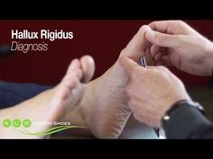 Hallux Rigidus Shoes, Hallux Rigidus, Ankle Pain, Knee Exercises, Surgery Recovery, Joints Pain Relief, Strong Mind, Medical Terms, Recovery Workout