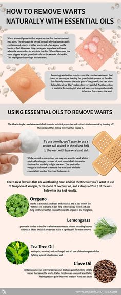 Essential Oils Warts, Natural Sleep Remedies, Cold Home Remedies, Lose 40 Pounds, Healthy Eating Habits, Natural Home Remedies