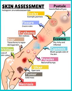 the different types of skin and how they are used to help them understand what it's like