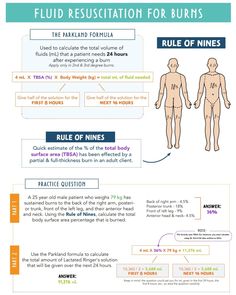 an info sheet with instructions on how to use fluid resections for burns