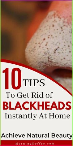 Blackheads, like many other acne forms, can be stubborn to remove. But don't worry, in this post we've researched and gathered the most effective ways to remove blackheads quickly at home. Tips on how you can easily get rid of blackheads pretty fast at home. how to get rid of blackheads, blackhead removal, naturally remove blackheads, beauty tips, beauty Ways To Remove Blackheads, Bleach Hair Dye, Blackheads Removal Cream, Vitamin C Face Mask, Tea Tree Face Wash, How To Remove Blackheads, Remove Blackheads From Nose, Blackhead Remedies, To Remove Blackheads