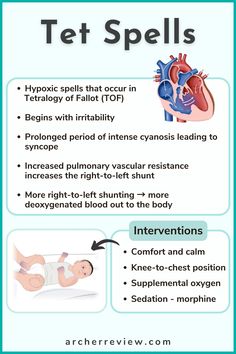 Tetralogy of Fallot is the most common type of cyanotic 💙 congenital heart defect.

This is actually made up of four defects that together cause the right-to-left shunting:
1️⃣ Ventricular septal defect (VSD)
2️⃣ Pulmonary stenosis
3️⃣ Right ventricular hypertrophy
4️⃣ Overriding aorta

Any time the pressure in the right side of the heart ⬆️ goes up, deoxygenated blood will be pushed across the ventricular septal defect, and the overriding aorta will send it out to the body.

If these babies are upset or 😭 crying, that will increase pressure in the lungs and in the right side of the heart…which means more deoxygenated blood will be sent ➡️ to the body!